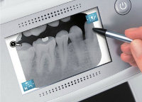 Dürr Dental VistaScan Mini View samostaný režim
